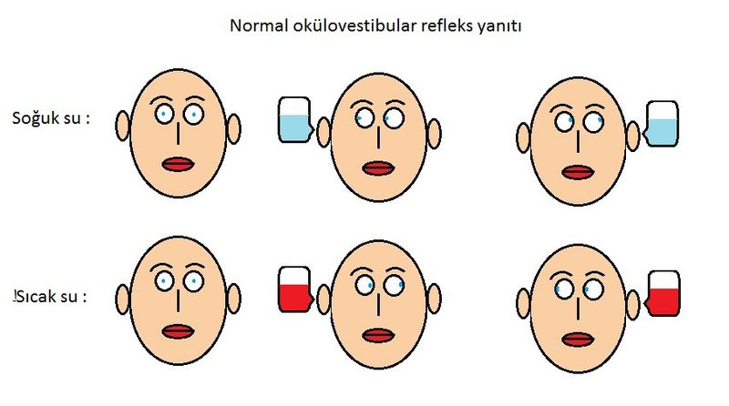 Dosya:Vestibulo ocular reflex.jpg